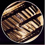 Imagen # 2 con fibroscopio